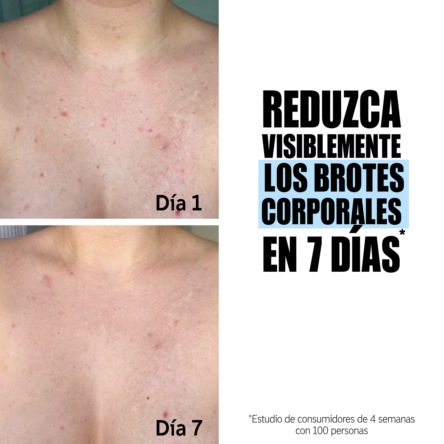 GLYCOLIC ACID EXFOLIATING BODY STICK (TRATAMIENTO EXFOLIANTE EN BARRA)